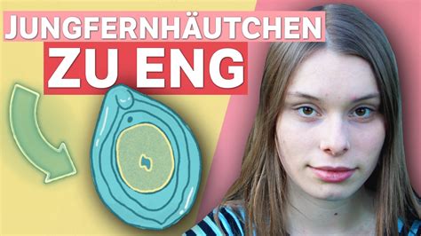 jungfernhäutchen echt|Hymen (früher: Jungernhäuchen)